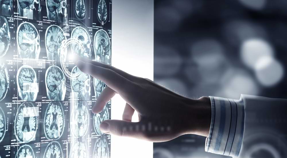 {featued_image:array_value|alt}